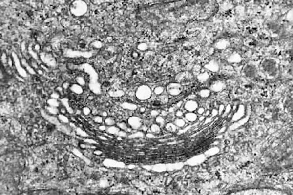 Golgi Apparatus by EM