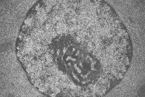 Nucleus